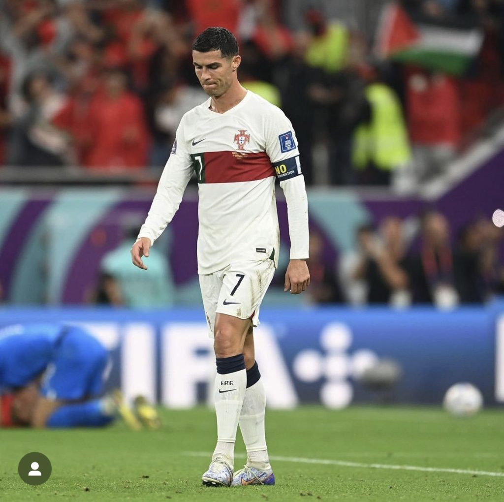 Capilike - cristiano ronaldo - transplante capilar